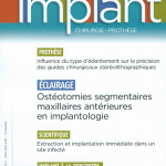 Implant 2016