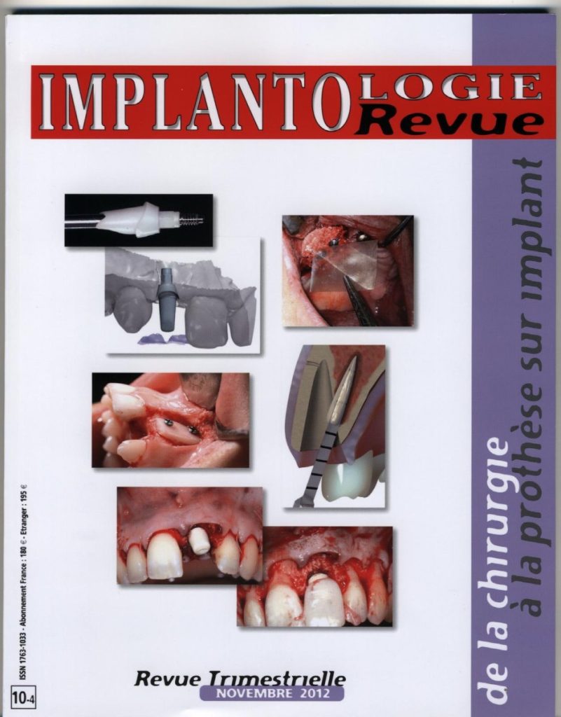 Implantologie 2012