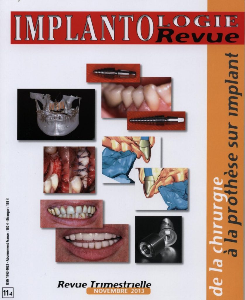 Implantologie 2013