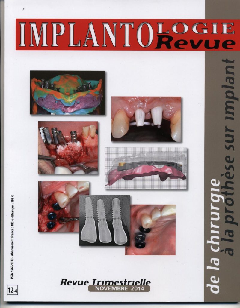 Implantologie 2014
